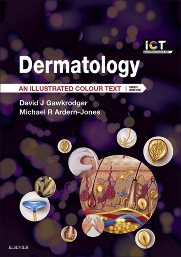 Dermatology An Illustrated Colour Text 6th Edition David J Gawkrodger