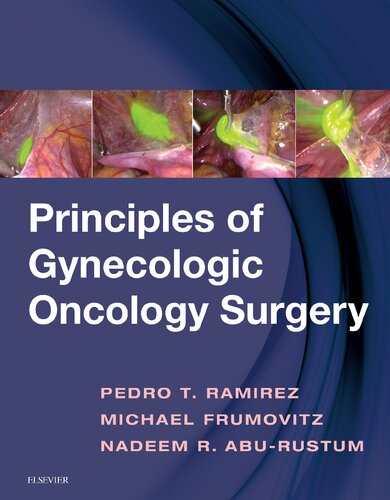 Principles Of Gynecologic Oncology Surgery 1st Edition Pedro T Ramirez