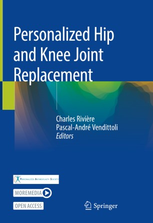 Personalized Hip And Knee Joint Replacement 1st Ed Charles Rivire