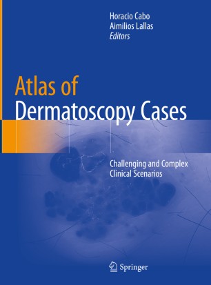 Atlas Of Dermatoscopy Cases Challenging And Complex Clinical Scenarios 1st Ed Horacio Cabo