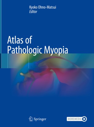 Atlas Of Pathologic Myopia 1st Ed Kyoko Ohnomatsui
