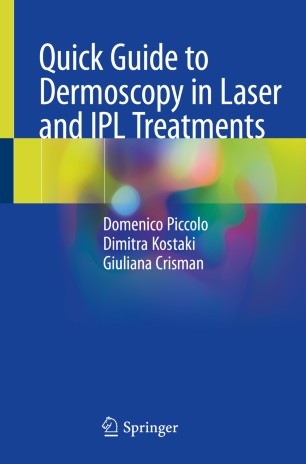 Quick Guide To Dermoscopy In Laser And Ipl Treatments 1st Ed Domenico Piccolo