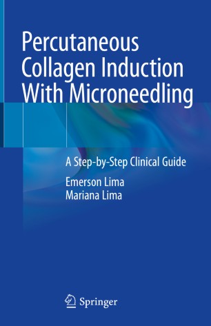 Percutaneous Collagen Induction With Microneedling A Stepbystep Clinical Guide 1st Ed Emerson Lima
