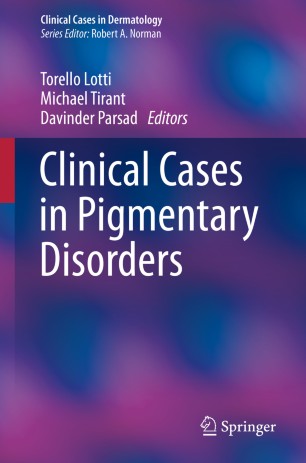 Clinical Cases In Pigmentary Disorders 1st Ed Torello Lotti