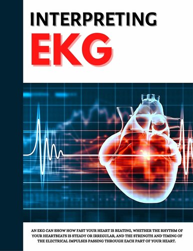 Interpreting Ekg Ekg Interpretation For Nurses Ekg Interpretation Practice Ekg Interpretation Book Mann