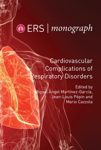 Cardiovascular Complications Of Respiratory Disorders Miguel Angel Martinezgarcia