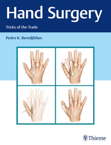 Hand Surgery Tricks Of The Trade 1st Edition Pedro Beredjiklian