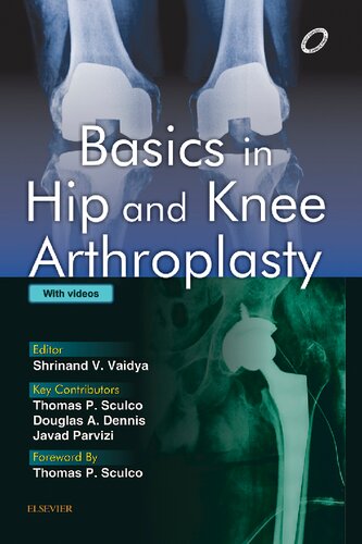 Basics In Hip And Knee Arthroplasty 1st Edition Shrinand Vaidya
