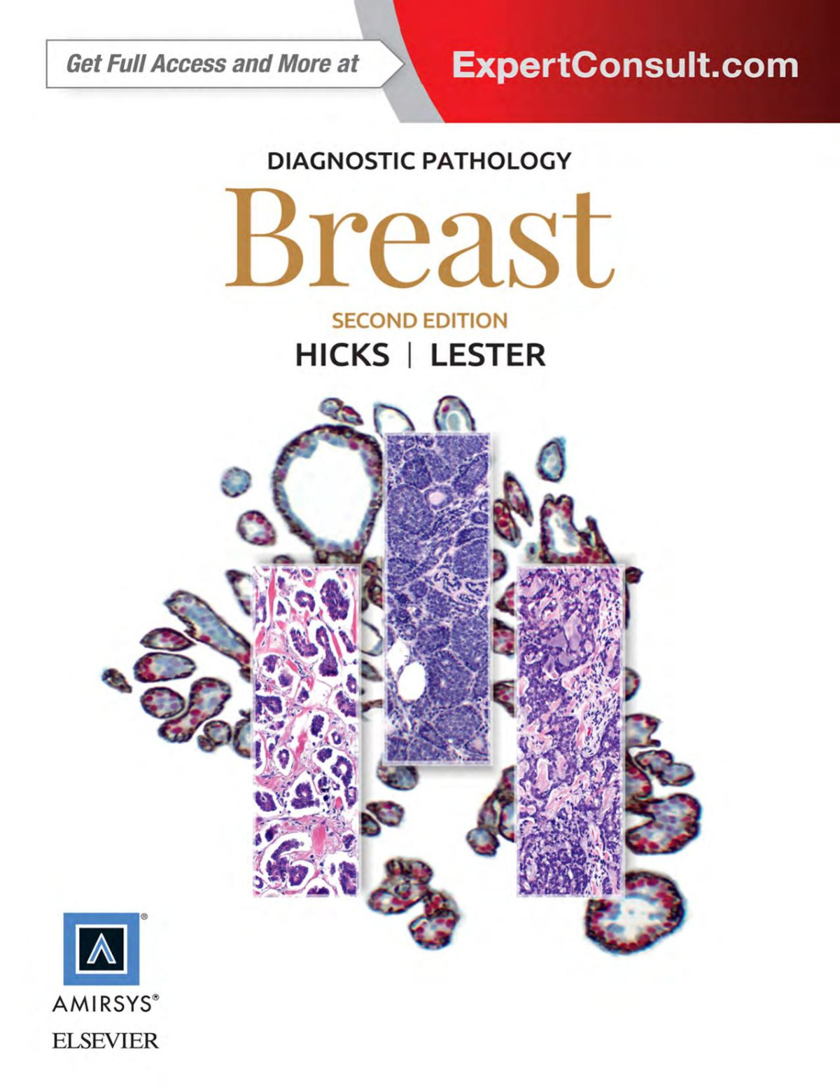 Diagnostic Pathology Breast David G Hicks Md Susan C Lester Md Phd