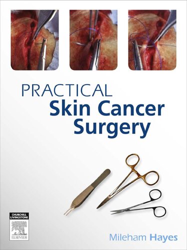 Practical Skin Cancer Surgery 1st Edition Mileham Hayes