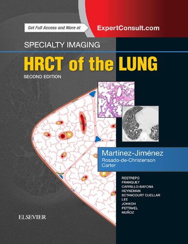 Specialty Imaging Hrct Of The Lung Santiago Martinezjimenez