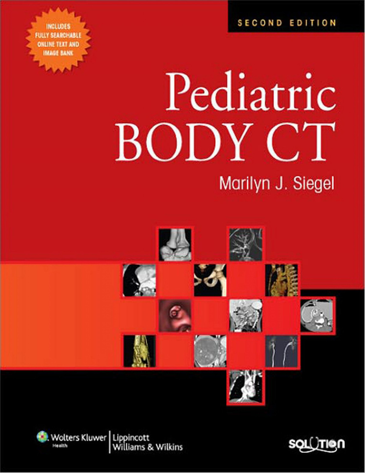Pediatric Body Ct 2nd Edition 1 222 Marilyn J Seigel