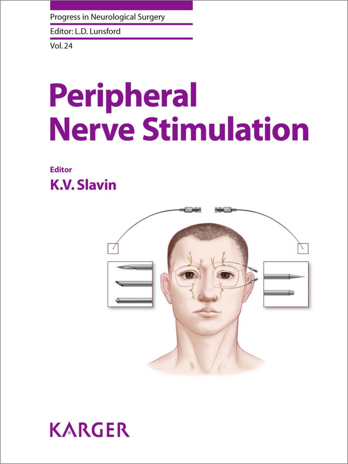 Peripheral Nerve Stimulation Slavin Konstantin V