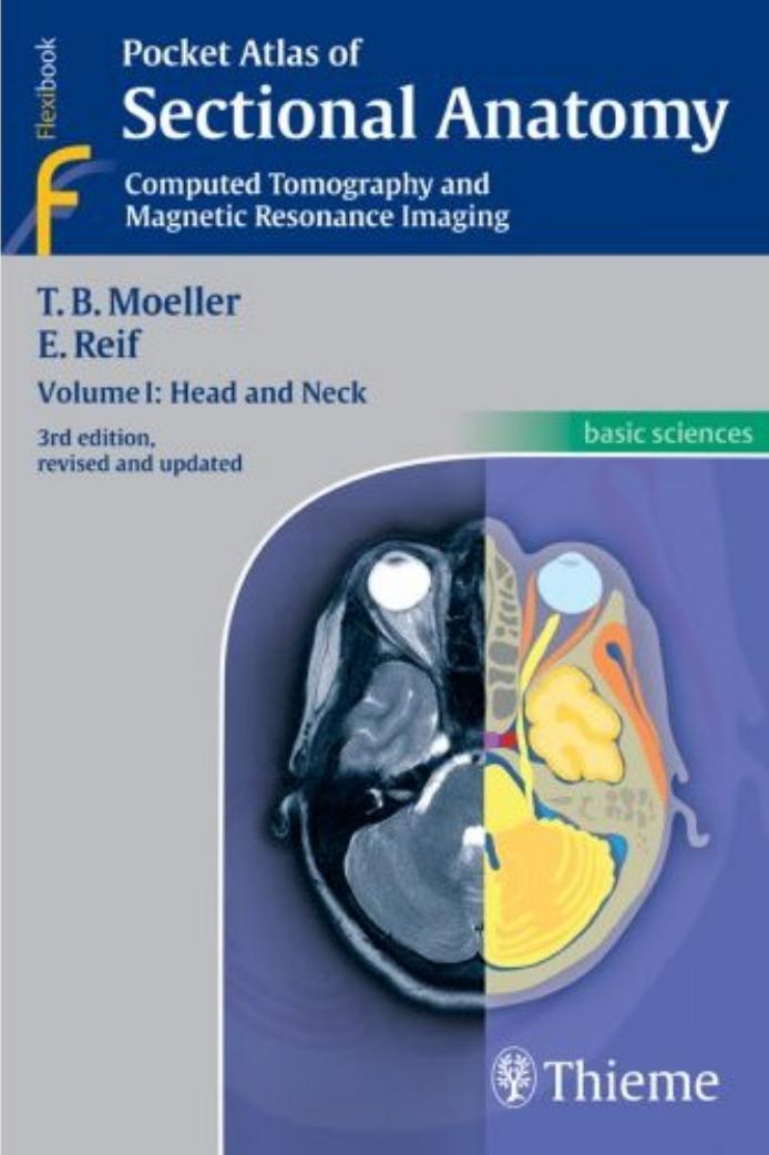 Pocket Atlas Of Sectional Anatomy Volume 1 Head And Neck 3rd Edition Torsten B Moeller
