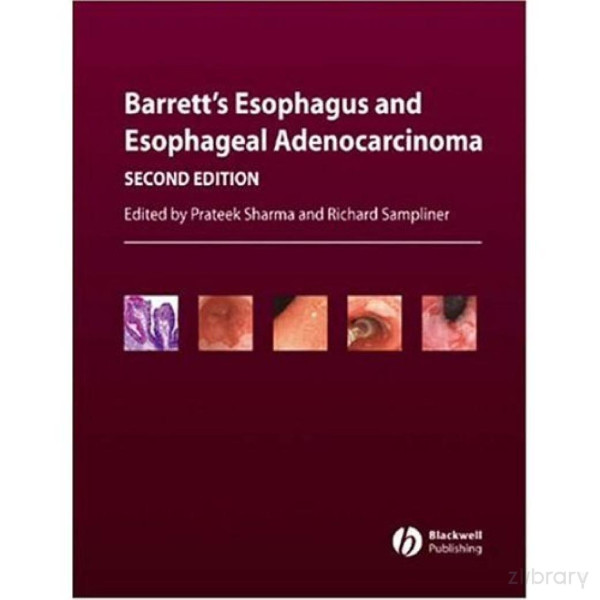 Barretts Esophagus And Esophageal Adenocarcinoma 2nd Ed 2nd Edition Prateek Sharma