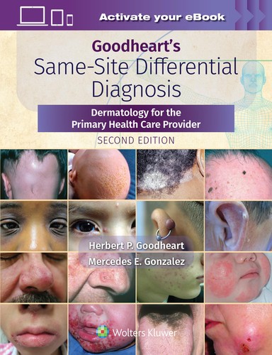 Goodhearts Samesite Differential Diagnosis Dermatology For The Primary Health Care Provider 2nd Edition Herbert Goodheart