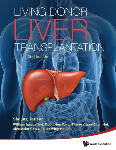 Living Donor Liver Transplantation 2e Mar 8 20119814329754wspcpdf 2nd Ed Sheung Tat Fan