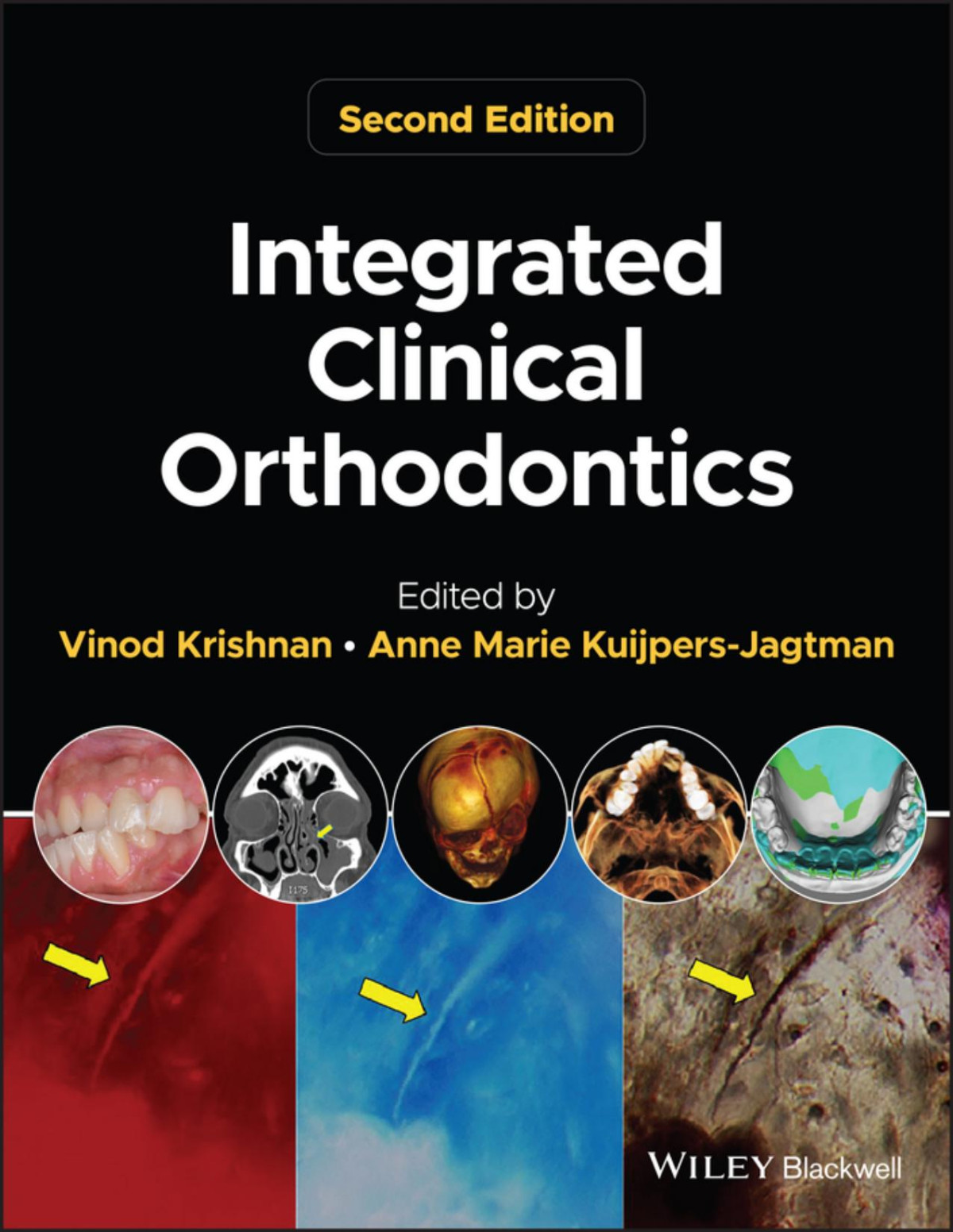 Integrated Clinical Orthodontics Vinod Krishnan Anne Marie Kuijpersjagtman 2nd Edition 2023 600 Pp Isbn 9781119870074 Vinod Krishnan