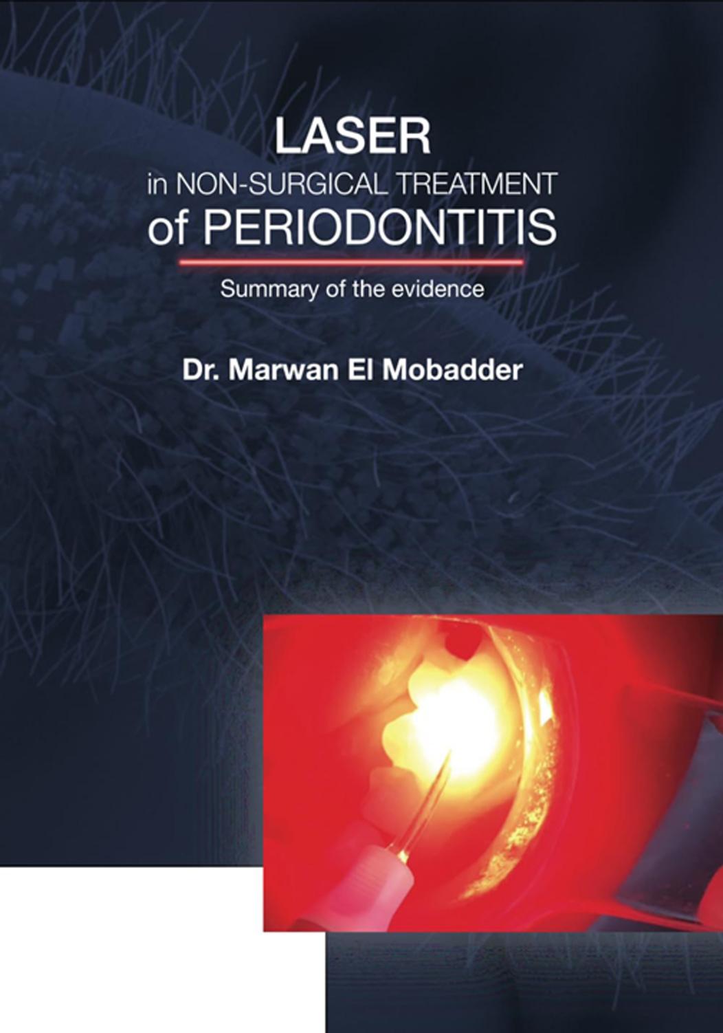 Laser In Nonsurgical Treatment Of Periodontitis Summary Of The Evidence Simply Explained Marwan Wassim El Mobadder 2021 101 Pp Isbn 9798528956886 Marwan Wassim El Mobadder