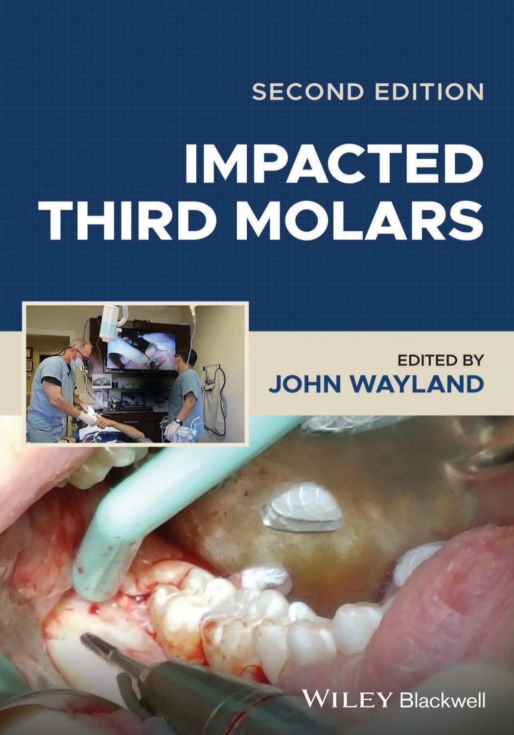 Impacted Third Molars John Wayland 2nd Edition 2023 330 Pp Isbn 9781119930310 John Wayland