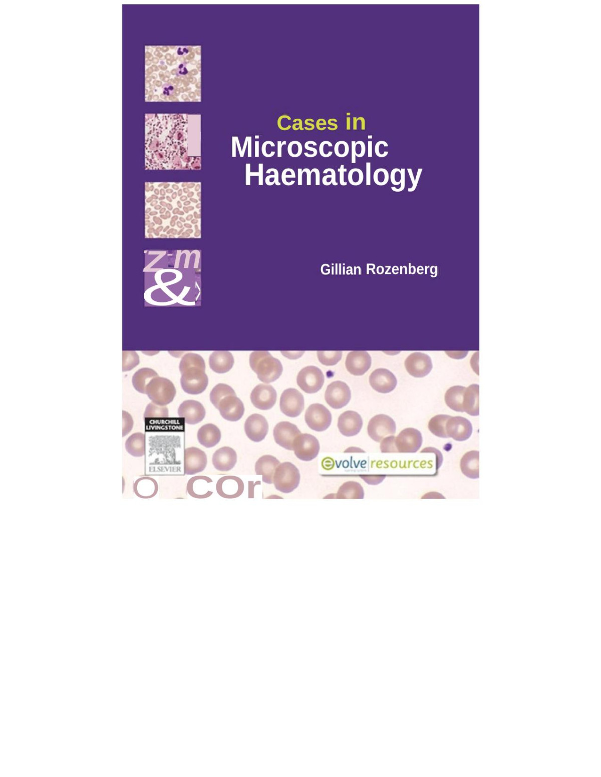 Cases In Microscopic Haematology 1st Edition Gillian Rozenberg Fams