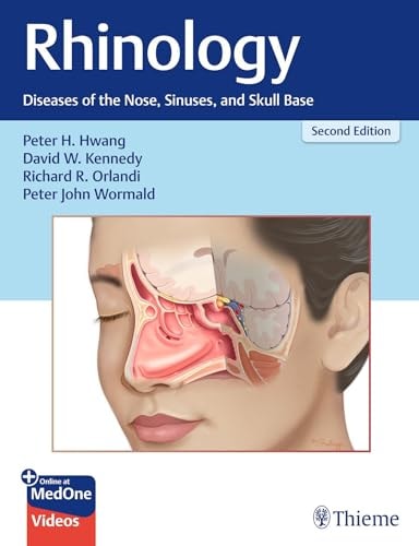 Rhinology Diseases Of The Nose Sinuses And Skull Base 2nd Edition Peter H Hwang