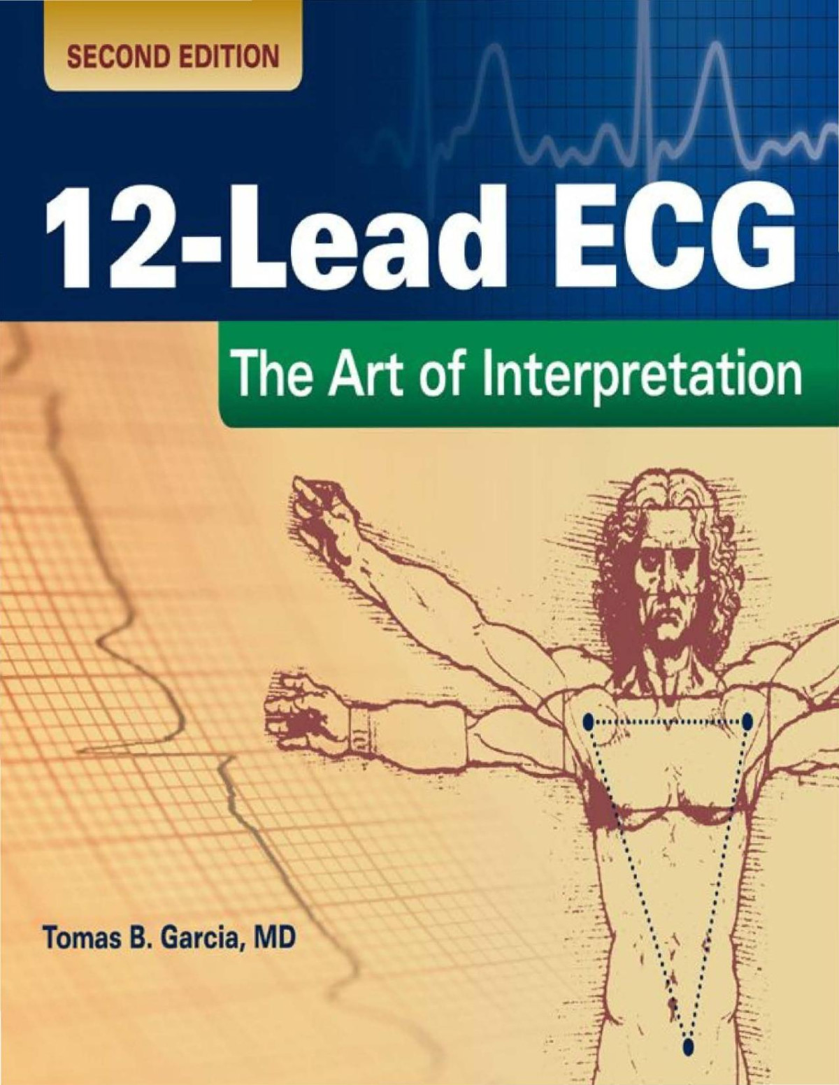 12lead Ecg The Art Of Interpretation Tomas B Garcia