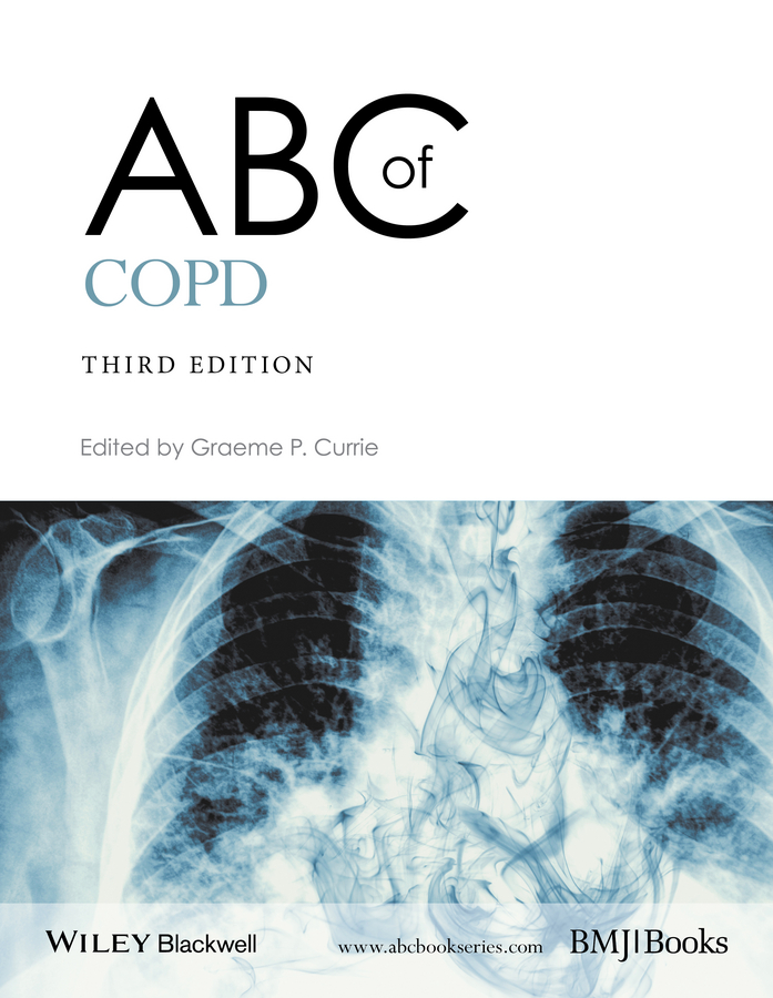 Abc Of Copd Graeme P Currie