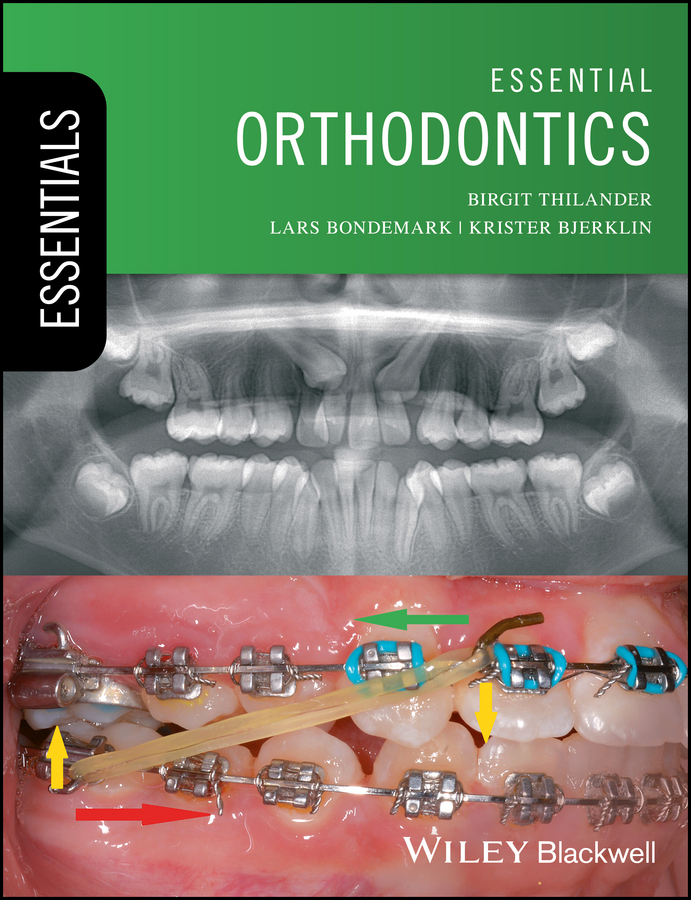 Essential Orthodontics Birgit Thilander Krister Bjerklin Lars Bondemark Krister Bjerklin Lars Bondemark