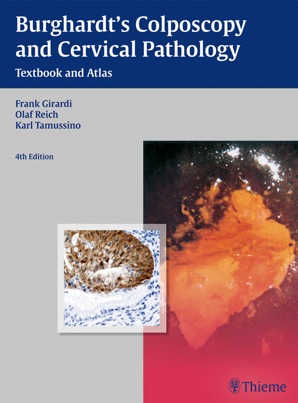 Burghardts Colposcopy And Cervical Pathology Girardi Frank Pickel