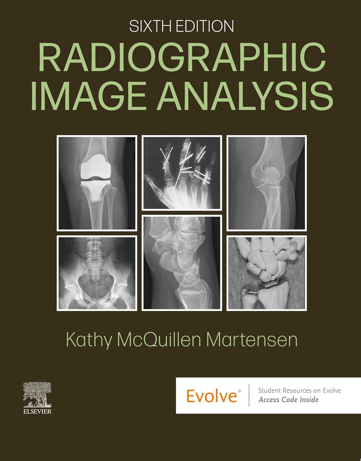 Radiographic Image Analysis 6e Feb 15 20240323930697elsevierpdf 6th Edition Kathy Mcquillenmartensen