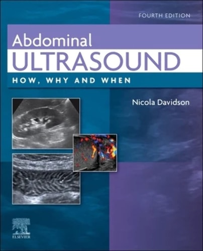 Abdominal Ultrasound How Why And When 4e Oct 10 20220702082430elsevierpdf 4th Edition Nicola Davidson