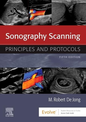 Sonography Scanning Principles And Protocols 5e Dec 3 20200323597386elsevierpdf 5th Edition M Robert De Jong
