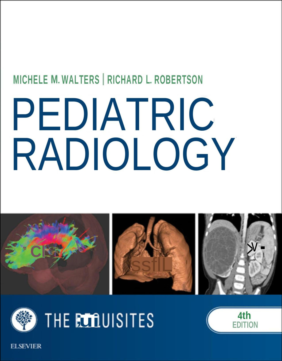 Pediatric Radiology The Requisites Requisites In Radiology 4e Nov 10 20160323323073elsevierpdf 4th Edition Michele M Walters Md Richard L Robertson Md
