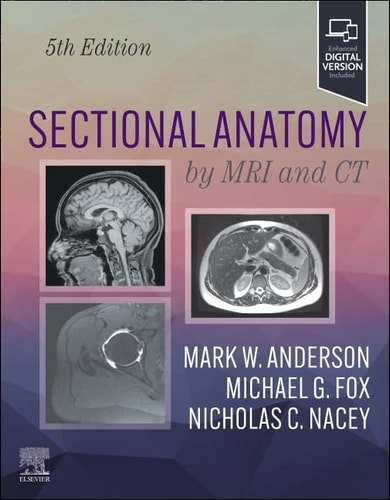 Sectional Anatomy By Mri And Ct 5e Jun 13 2024032393448xelsevierpdf 5th Edition Mark W Anderson