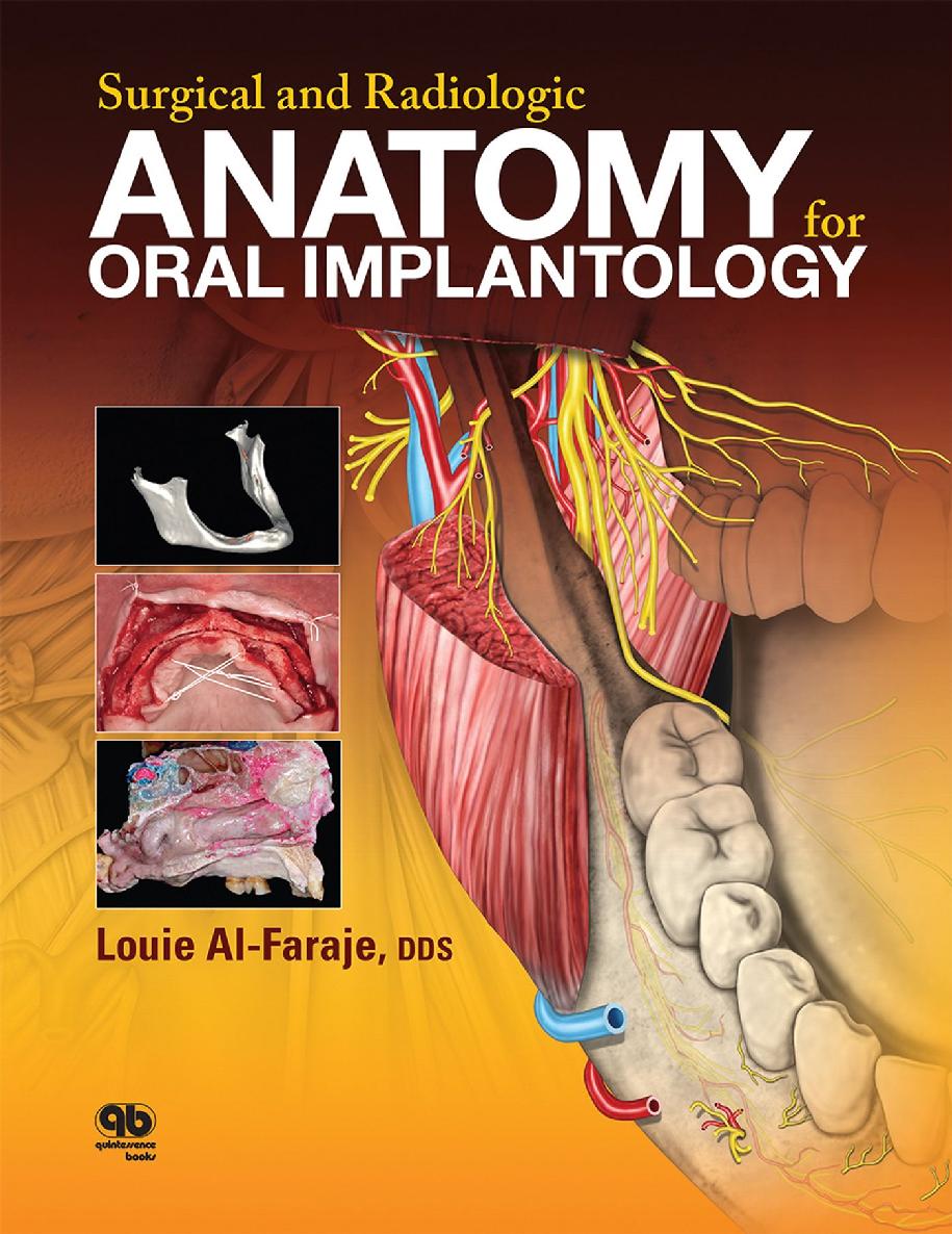 Surgical And Radiologic Anatomy Of Oral Implantology Louie Alfaraje