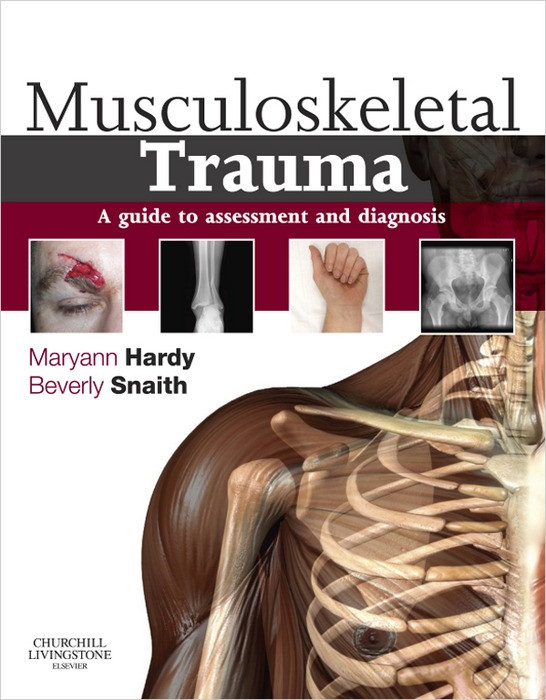 Musculoskeletal Trauma A Guide To Assessment And Diagnosis Maryann Hardy Beverly Snaith