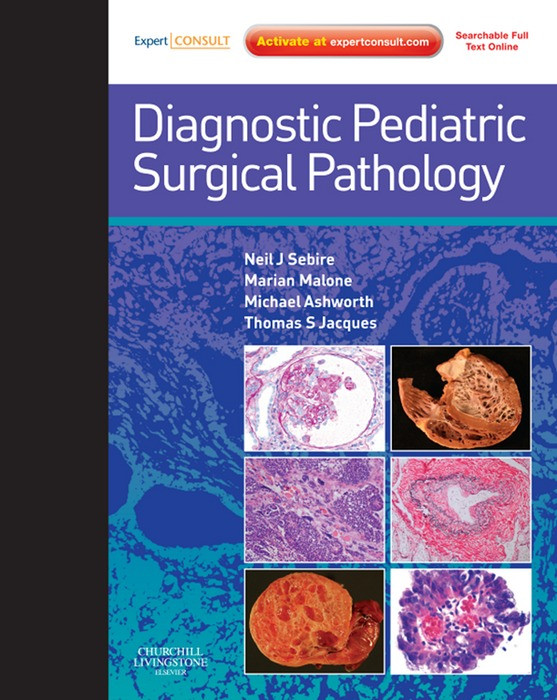 Diagnostic Pediatric Surgical Pathology Neil Sebire Marian Malone Michael Ashworth Thomas S Jacques
