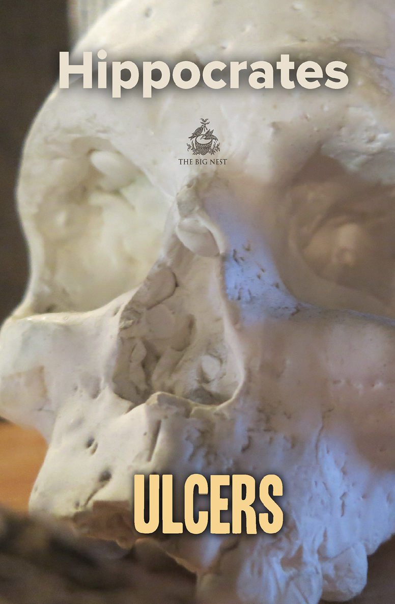 Ulcers Medical Library Hippocrates