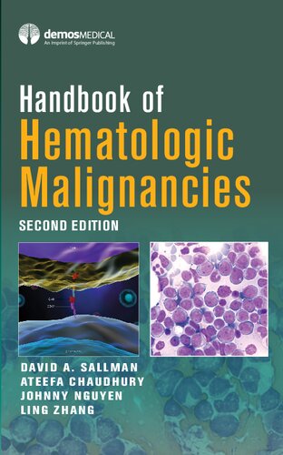 Handbook Of Hematologic Malignancies Second Md Ling Zhang Editor Ateefa Chaudhury Editor Johnny Nguyen Editor David A Sallman Editor