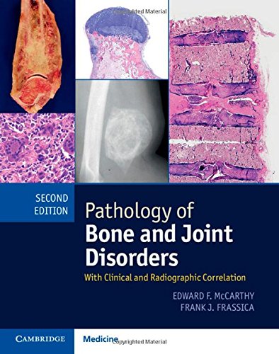 Pathology Of Bone And Joint Disorders With Clinical And Radiographic Correlation 2nd Edition Edward F Mccarthy