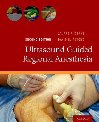 Ultrasound Guided Regional Anesthesia 2nd Edition David B Auyong Stuart A Grant