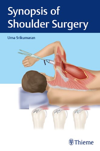 Synopsis Of Shoulder Surgery 1st Edition Uma Srikumaran
