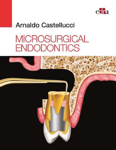 Microsurgical Endodontics 1st Edition Arnaldo Castellucci