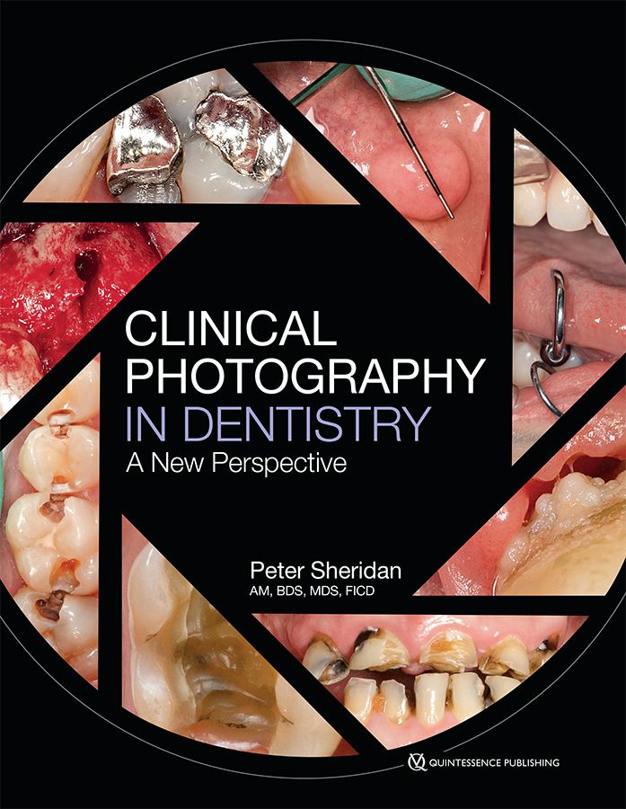 Clinical Photography In Dentistry A New Perspective Sheridan