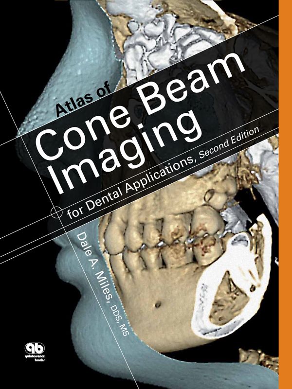 Atlas Of Cone Beam Imaging For Dental Applications Second Edition Dale A Miles