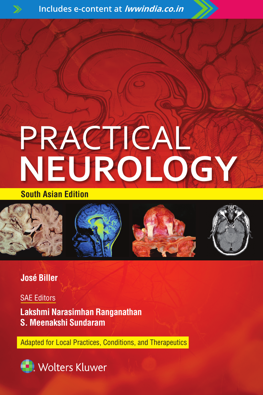 Practical Neurology South Asian Edition Sae Lakshmi Narasimhan Ranganathan