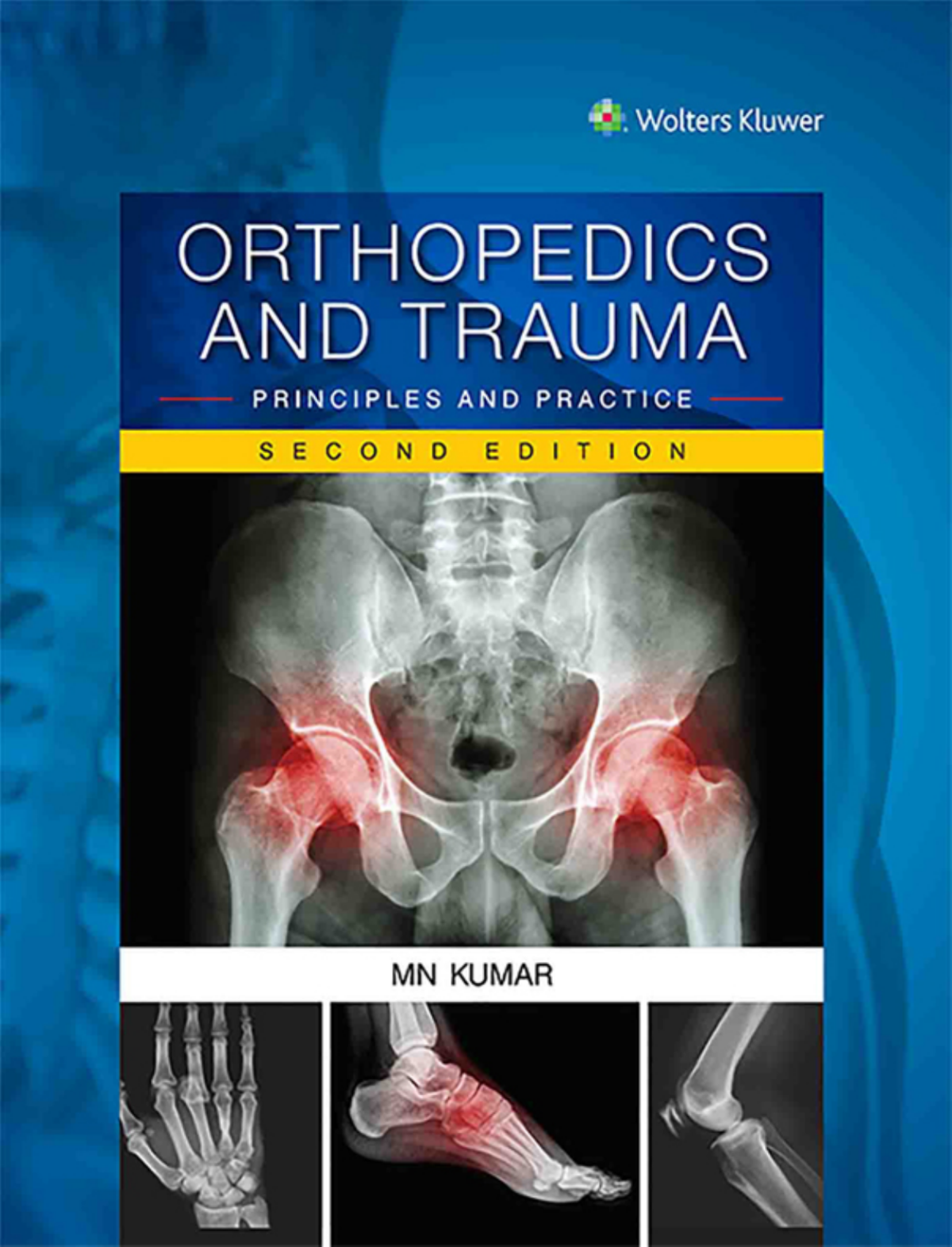 Orthopedics And Trauma Principles And Practice 2nd Edition Kumar
