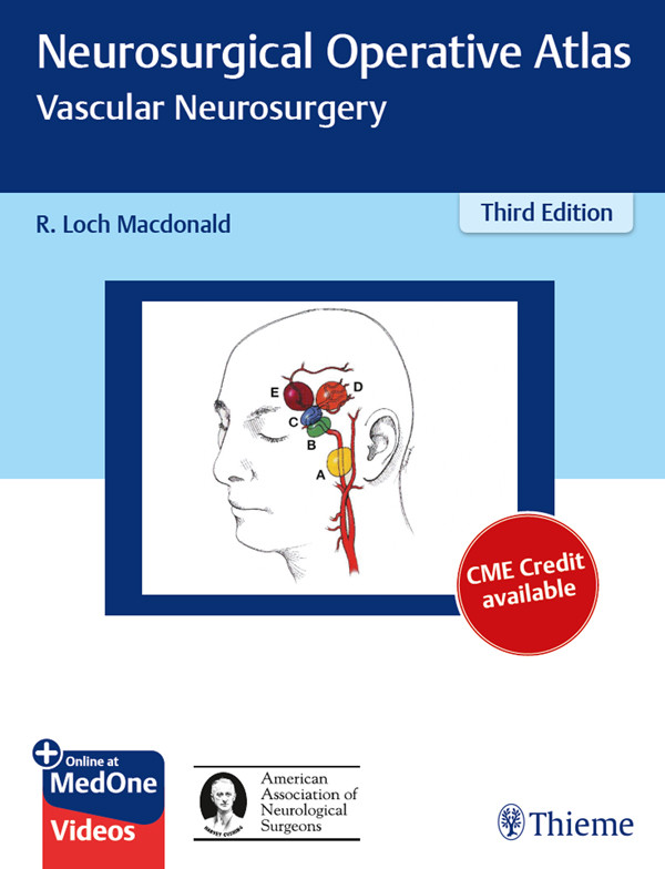 Neurosurgical Operative Atlas Vascular Neurosurgery R Loch Macdonald