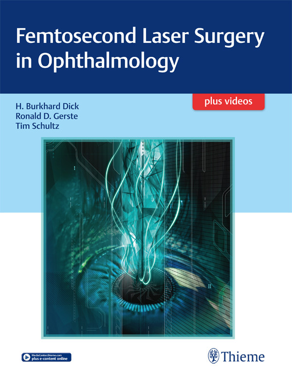 Femtosecond Laser Surgery In Ophthalmology Dick H B Gerste